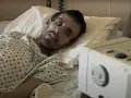 Skąd wziął się HIV? Historia wirusa i jego podróż po świecie